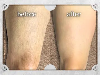 都度払い脱毛 Lino柏/Moneのエステ・リラクイメージ