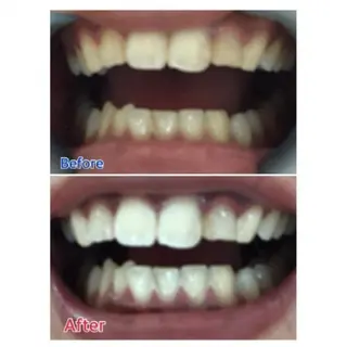 M渋谷店所属・Ｍ渋谷 ホワイトニングのエステ・リラクイメージ