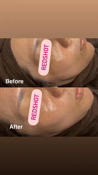 Lala Beautyのエステ・リラクイメージ