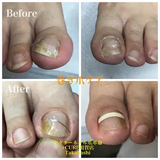 メンズ ネイル ドクターネイル爪革命 takahashiのその他イメージ