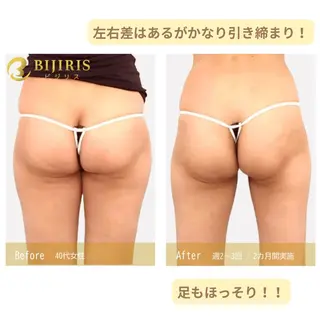 セルフ脱毛/美尻イス キングスサロン熊本のエステ・リラクイメージ