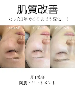 渡邊 千夏のエステ・リラクイメージ