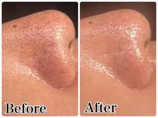 Gemini 　MIKIのエステ・リラクイメージ