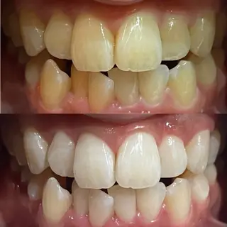 Reliana所属・ホワイトニング Relianaのその他イメージ