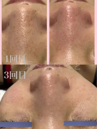 うえつま ふみえのエステ・リラクイメージ