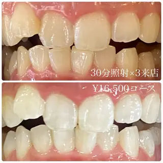 PLATINUM Beauty 横浜店所属・ホワイトニングルーム 横浜店のその他イメージ