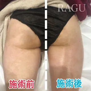 RAGU BEAUTY所属・原口 彩子のエステ・リラクイメージ