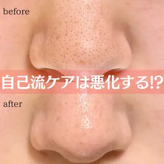 Ella〜eye&beauty〜所属・Ella【エラ】 毛穴専門サロンのエステ・リラクイメージ