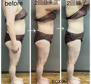 ECXIA 【エクシア】のエステ・リラクイメージ