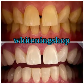 ホワイトニング ショップ吉祥寺店のエステ・リラクイメージ