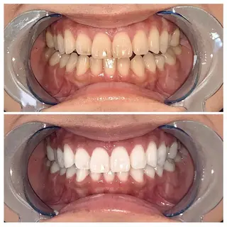 カラー メンズ マツエク・マツパ ネイル ヘアアレンジ パーマ キッズ アイブロウ ロング ライトビューティー 銀座本店のエステ・リラクイメージ