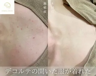 脱毛・眉毛・フェイス サロンN久留米店の眉毛・アイブロウイメージ