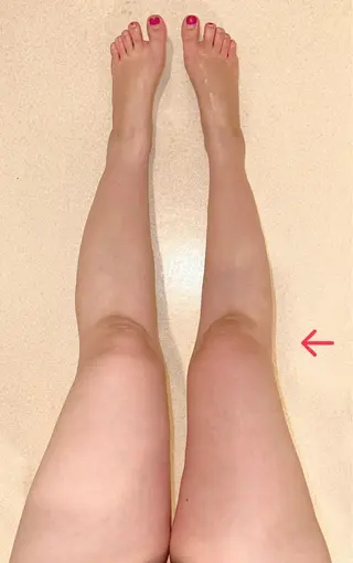 夏までに！ -5kgチャレンジのエステ・リラクイメージ