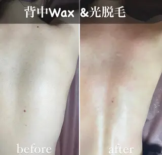 エピナス町田店 ブラジリアンワックスのエステ・リラクイメージ