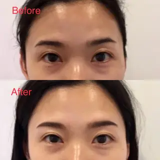 アイブロウ Tommy所属・Tommy. MIZUKIの眉毛・アイブロウイメージ