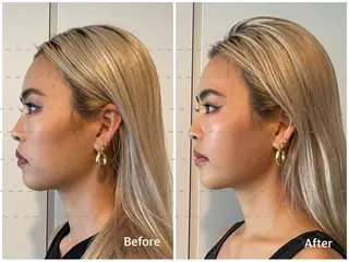 THE  ROOTS所属・美容鍼♡小顔矯正♡ fumikaのエステ・リラクイメージ