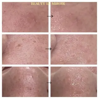 ビューティー ミロワールのエステ・リラクイメージ