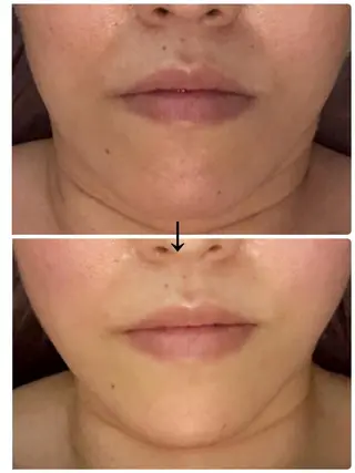 pushup tomoのエステ・リラクイメージ