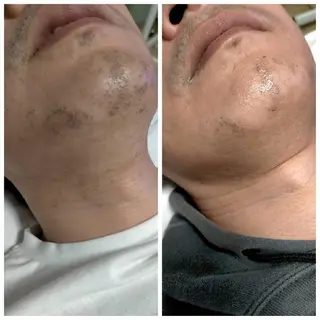 muscle＆esthe jonny's beauty所属・jonny's beautyのエステ・リラクイメージ