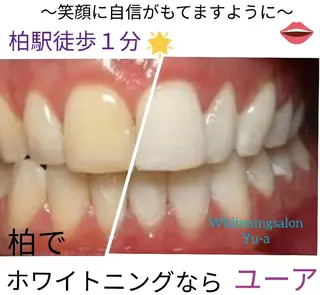 yu-a☆  ネイル ＆ホワイトニングのネイルデザイン