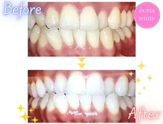 エクシアホワイトニング前橋店所属・セルフホワイトニング エクシア前橋店のその他イメージ