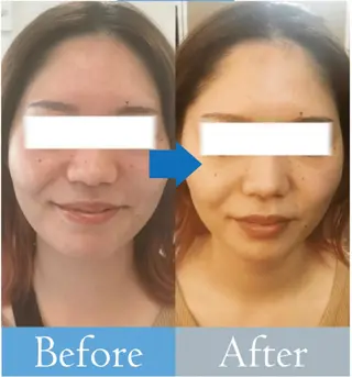 美肌/小顔/眉毛の 専門店 ルミナスのエステ・リラクイメージ