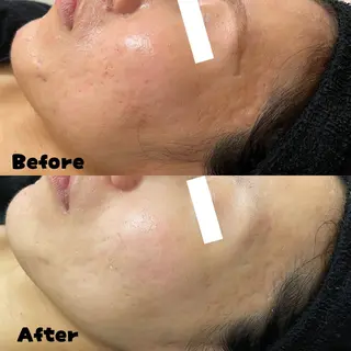 lapeca〜ラペカ〜所属・肌ケアサロン🌿 lapeca 土井のエステ・リラクイメージ