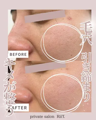private salon Rii'f.所属・private sa lon Rii'f.のエステ・リラクイメージ
