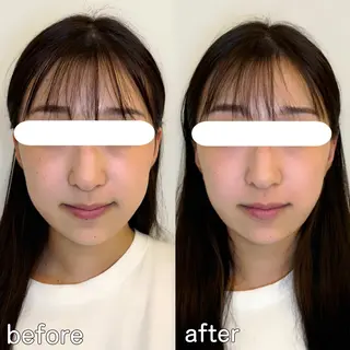 小顔矯正&美容整体 整え屋REDオーナーのエステ・リラクイメージ