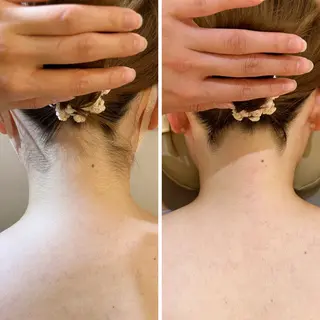 うなじ脱毛/美肌脱毛 LABELのエステ・リラクイメージ