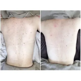 毛穴/毛穴洗浄専門 エミルカ船橋のエステ・リラクイメージ