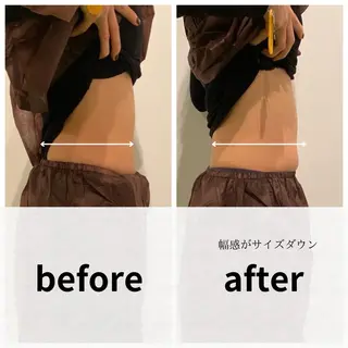 美容鍼/ヘッドスパ/ 💎さかもとのエステ・リラクイメージ