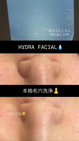 トータルビューティーサロンFirstclass所属・Firstclass Erikaのエステ・リラクイメージ