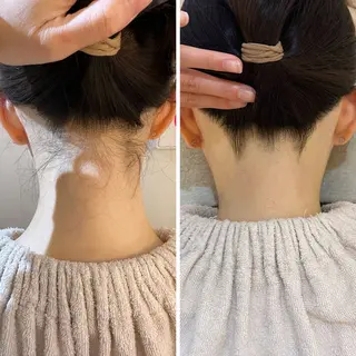 うなじ脱毛/美肌脱毛 LABELのエステ・リラクイメージ