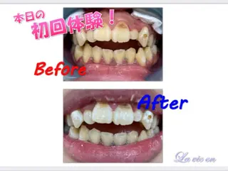 セルフホワイトニングサロン　ラヴィアン所属・ホワイトニングサロン La vie enのその他イメージ