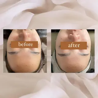 crescent所属・【韓国肌管理・脱毛】 クレセントのその他イメージ