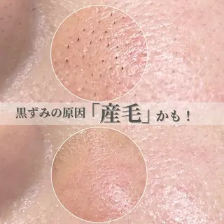 毛穴専門サロンLatiele所属・毛穴専門サロン Latieleのエステ・リラクイメージ