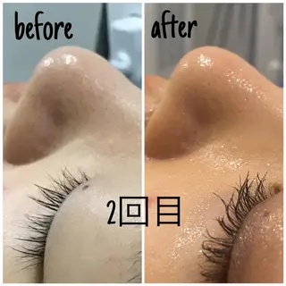 毛穴洗浄・痩身・脱毛 /アルカンジュのエステ・リラクイメージ