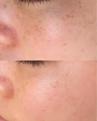 伊藤 稚菜のエステ・リラクイメージ