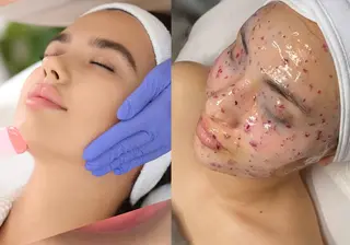 肌質改善サロンand...所属・肌質改善サロン and...のエステ・リラクイメージ