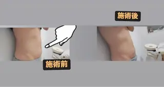 浮腫み，冷え性、 体質改善、のエステ・リラクイメージ