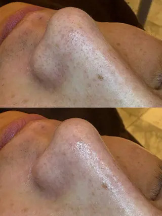 EARTH coiffure beaute 新潟紫竹山店所属・🤍アベシュリ /フェイシャル🤍のエステ・リラクイメージ