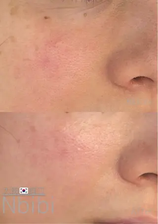 韓国🇰🇷価格 サロン_Nbibiのエステ・リラクイメージ