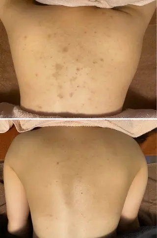 エレファンテブランコ所属・エレファンテブランコ yukariのエステ・リラクイメージ