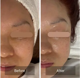 小顔リフト整顔/ 美肌サロンのその他イメージ