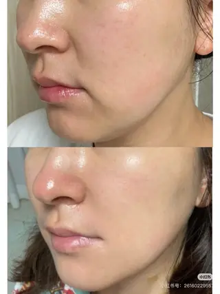 カラー aliaハイフ&水光ジェットサロン所属・aliaハーブ水光店 エステティシャン募集のエステ・リラクイメージ