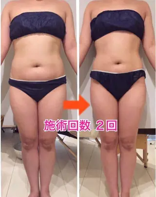 ロング カラー パーマ ヘアアレンジ メンズ キッズ ネイル マツエク・マツパ ‍痩身＆ボディ 結果出し🌟丹野のエステ・リラクイメージ