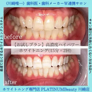 ホワイトニング専門店 PLATINUM Beauty 川崎店所属・PLATINUM Beauty 川崎店のその他イメージ