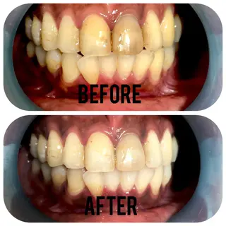 two nailのネイルデザイン