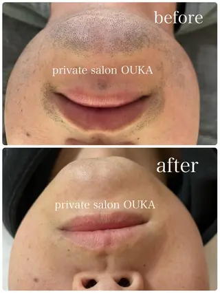 メンズ private salon OUKA所属・OUKA脱毛 毛穴ケアフェイシャルのエステ・リラクイメージ
